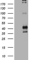 Monoclonal Mouse anti-Human FCER2 / CD23 Antibody (clone OTI3A2, IHC, WB)