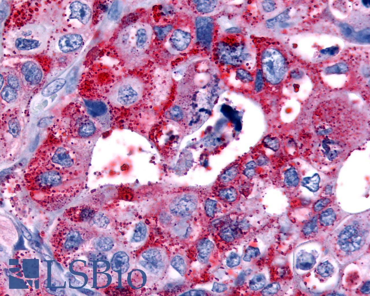 PathPlus™ HRH4 / Histamine H4 Receptor Antibody (Cytoplasmic Domain)