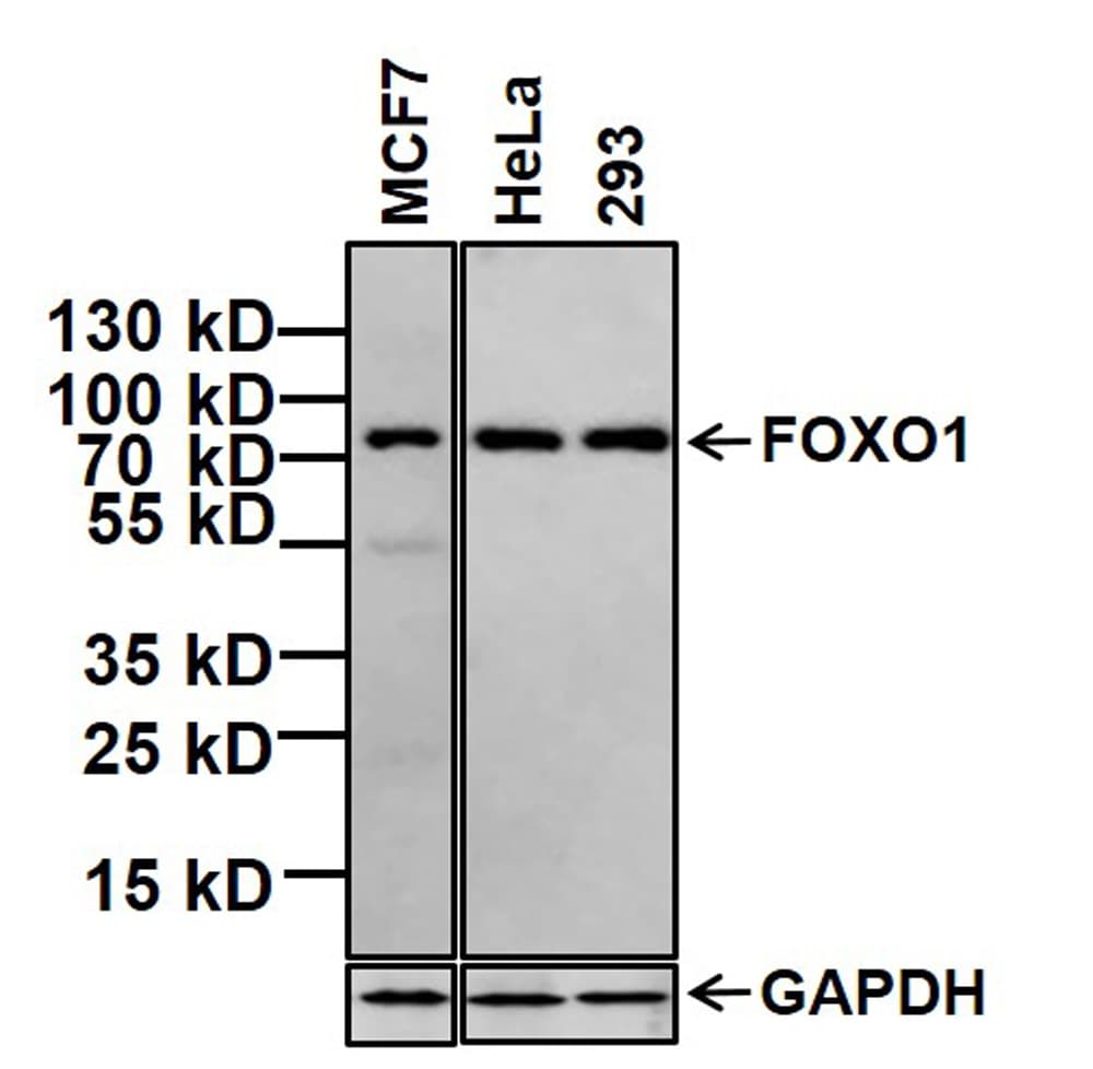 FOXO1 / FKHR Antibody (clone 3B6)