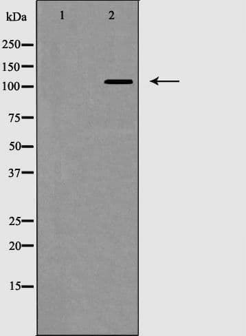 Polyclonal Rabbit anti-Human EPHB2 / EPH Receptor B2 Antibody (IF, WB)