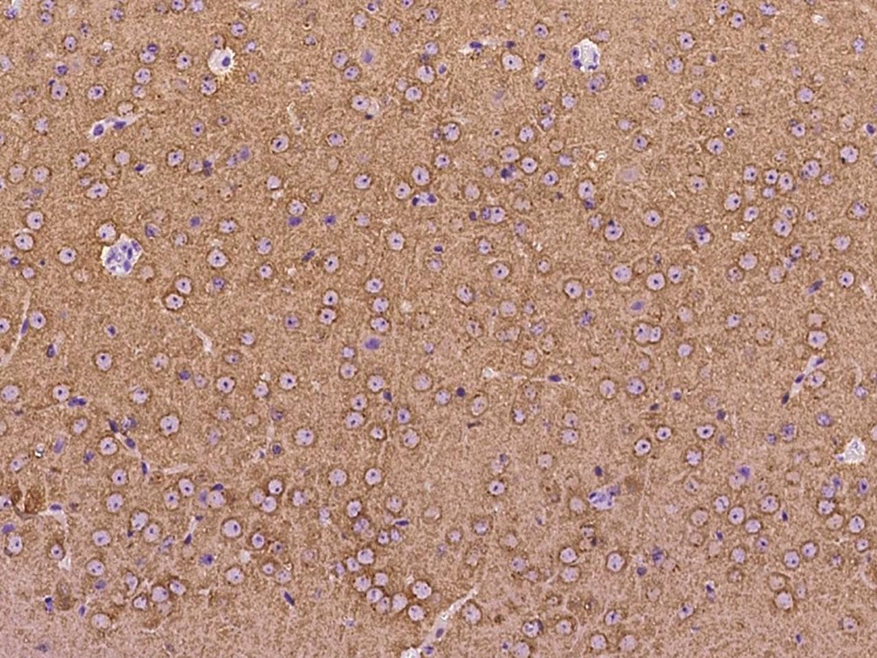 Syndapin I / PACSIN1 Antibody