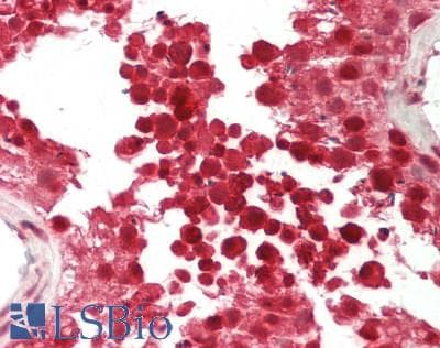 IHC-plus™ NBN / Nibrin Antibody