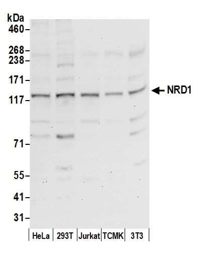 Polyclonal Rabbit anti-Human NRD1 / Nardilysin Antibody (aa275-325, WB)