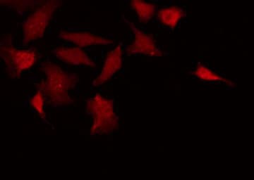 EIF2AK2 / PKR Antibody (phospho-Thr446)
