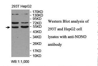 Polyclonal Rabbit anti-Human NONO / P54NRB Antibody (aa214-387, IHC, WB)