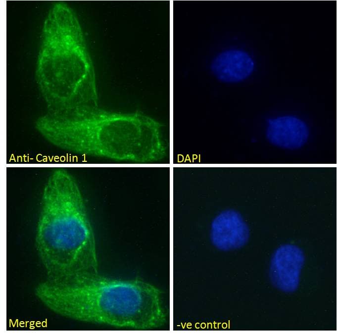PathPlus™ Polyclonal Goat anti-Human CAV1 / Caveolin 1 Antibody (aa73-84, IHC, IF, WB)