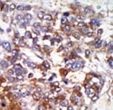 PKG / PRKG1 Antibody (aa629-660)