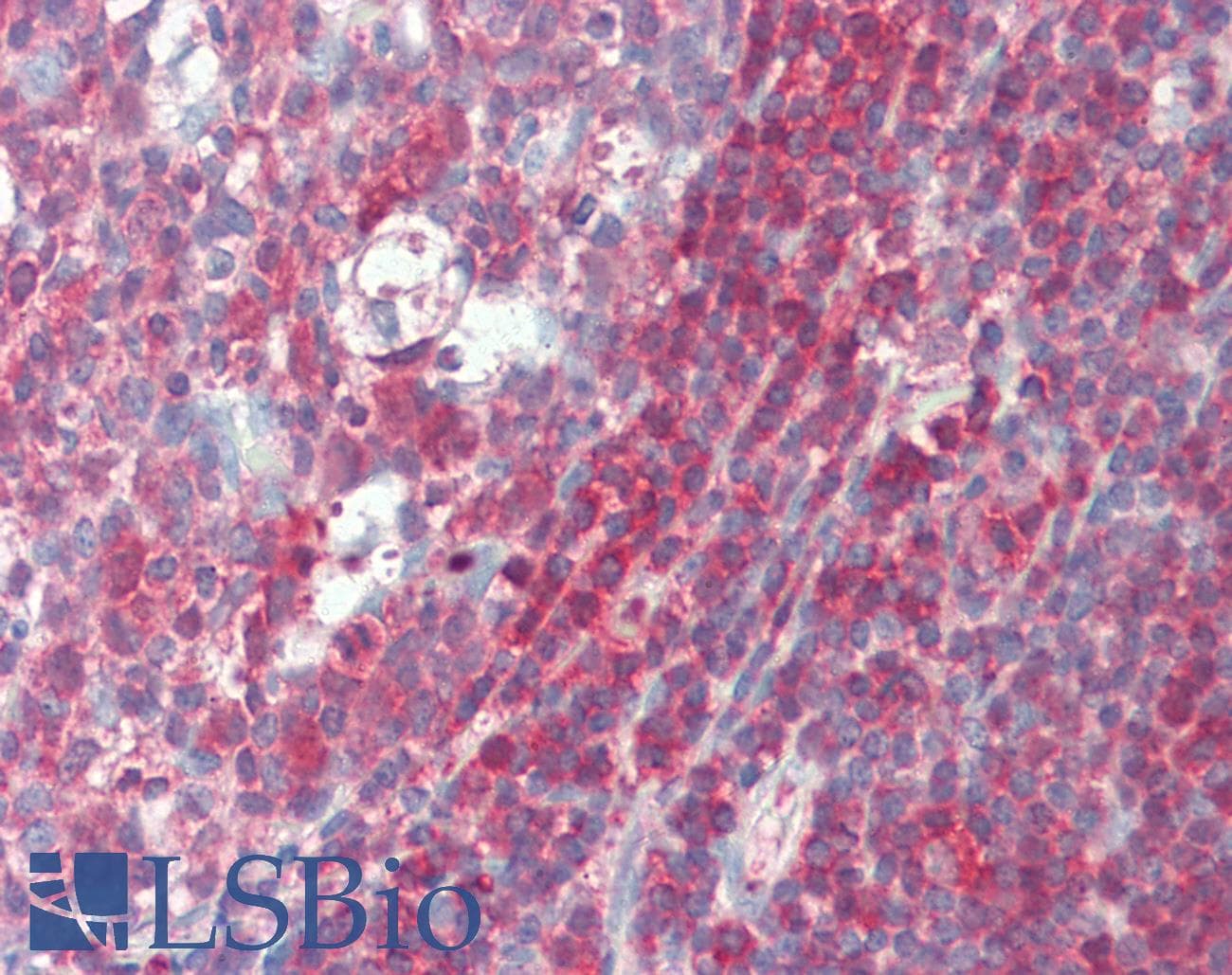 PNP / Nucleoside Phosphorylase Antibody (aa68-289)