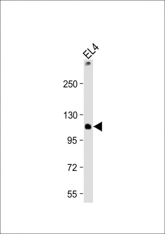 IHC-plus™ TIRC7 / TCIRG1 Antibody (C-Terminus)