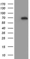 ESRRG / ERR Gamma Antibody (clone OTI6G1)