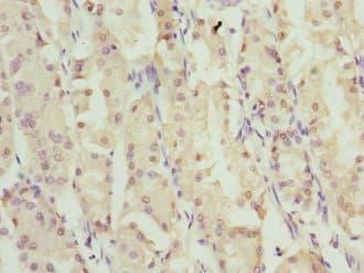 Polyclonal Rabbit anti-Human ZNF549 Antibody (IHC, WB)
