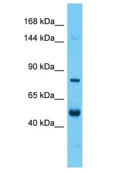 Polyclonal Rabbit anti-Human NYAP2 Antibody (aa131-180, WB)