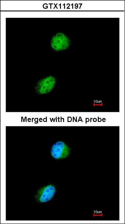 KAT5 / TIP60 Antibody