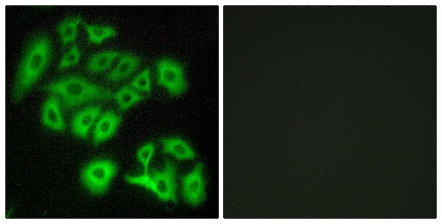 Polyclonal Rabbit anti-Human FZD4 / Frizzled 4 Antibody (IF)