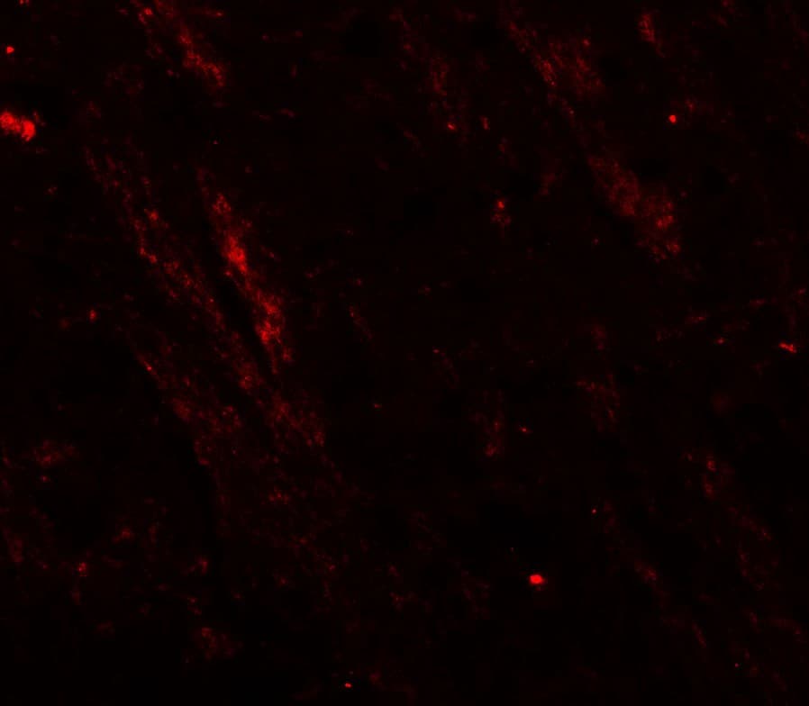 IHC-plus™ CACNA1H / Cav3.2 Antibody