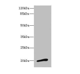 Polyclonal Rabbit anti-Human NMU / Neuromedin U Antibody (IHC, WB)
