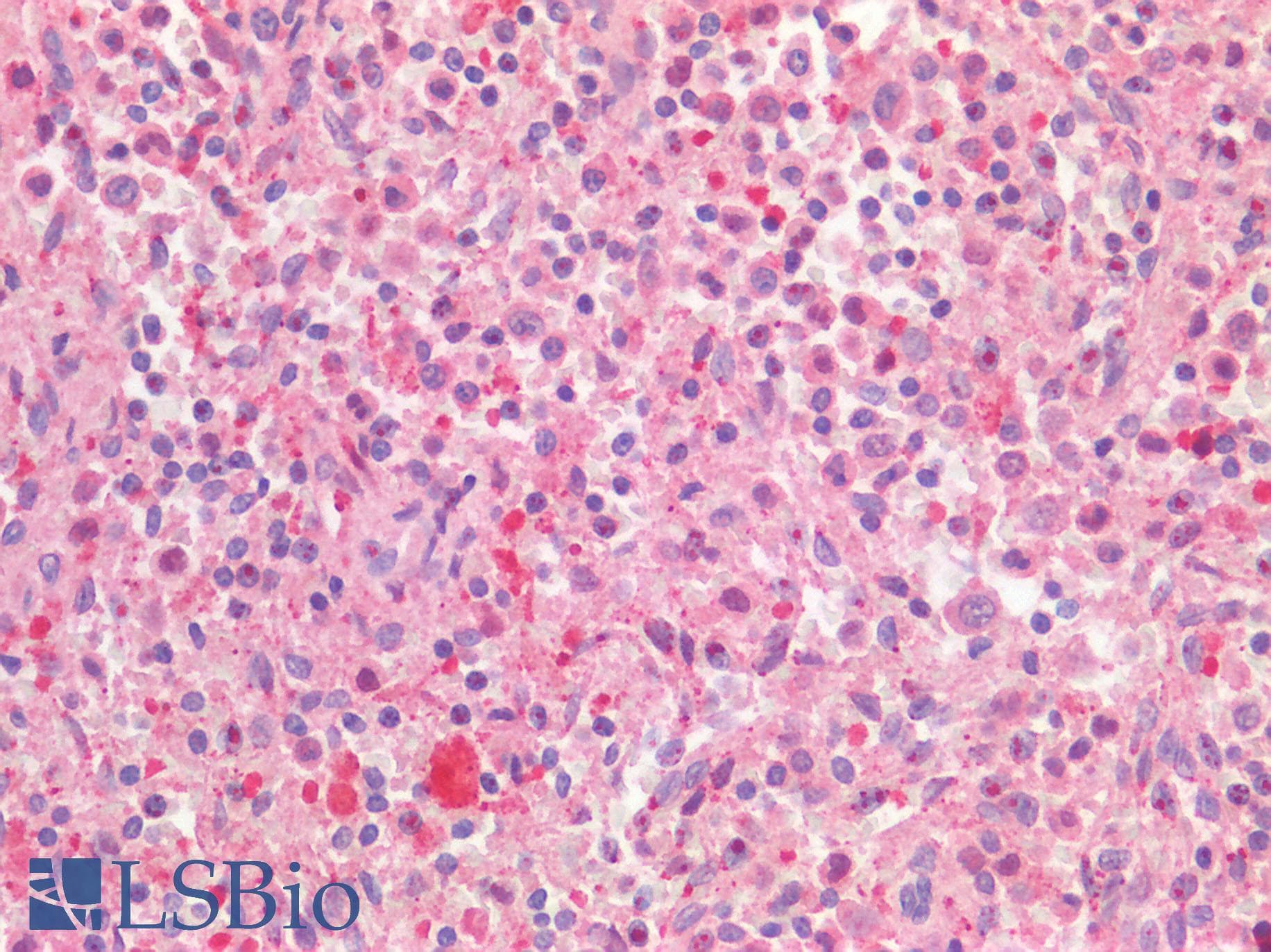CSF2RA / CD116 Antibody (clone 2G5)