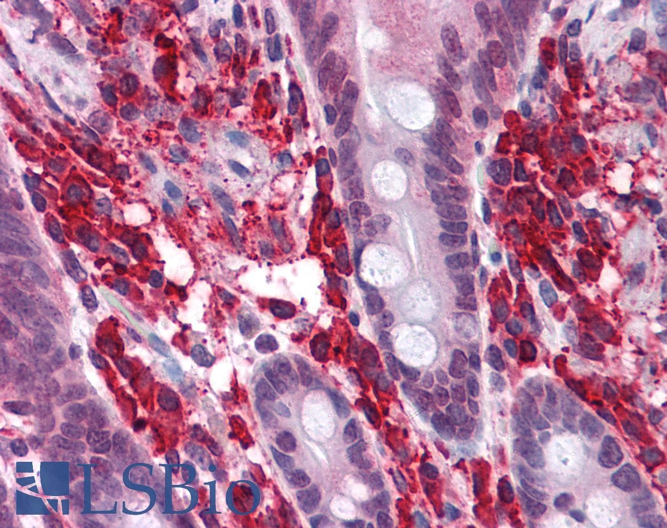 IHC-plus™ ZNF521 Antibody