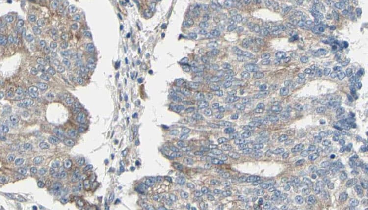 ARPC1A Antibody