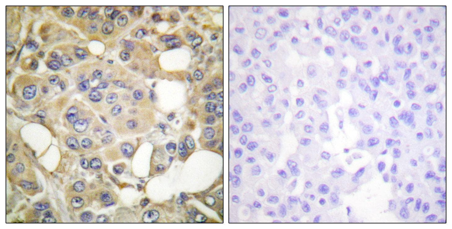 MARK1+2+3+4 Antibody (phospho-Thr215)