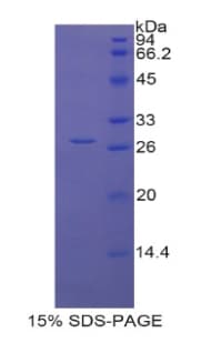 Rat LOXL1 Protein (Recombinant His-T7)