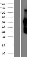 DACH2 Protein (Over-Expression Lysate Myc-DDK (Flag))