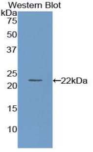 PON1 / ESA Antibody (Cy3)