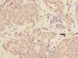 Polyclonal Rabbit anti-Rainbow trout TGFB1 / TGF Beta 1 Antibody (IHC, WB)