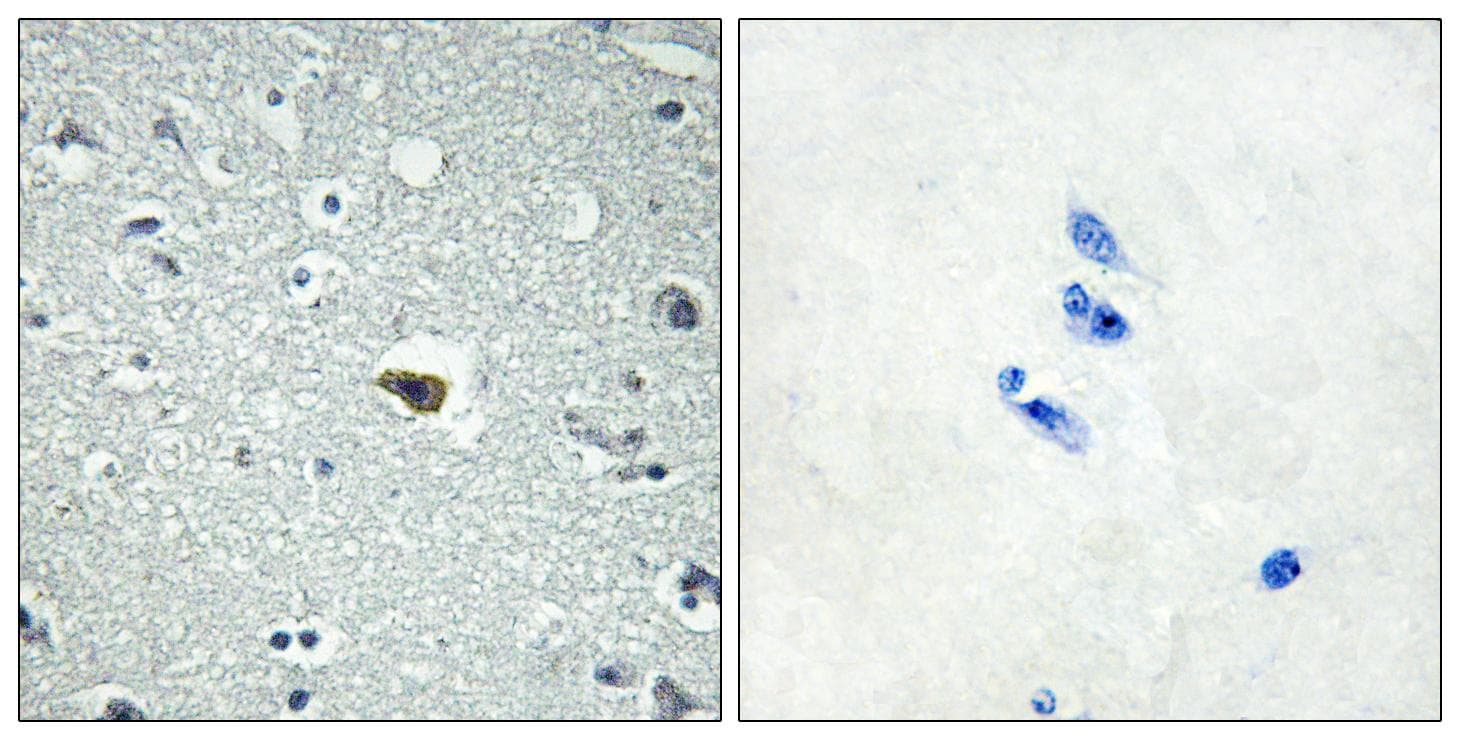 ADGRB1 / BAI1 Antibody