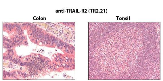 TNFRSF10B / Killer / DR5 Antibody (clone TR2.21)