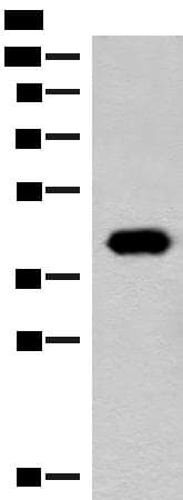 GIPC1 / GIPC Antibody