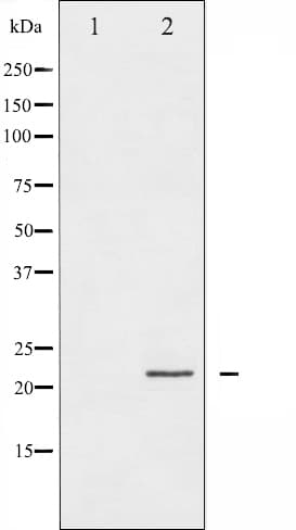 PPP1R14A / CPI-17 Antibody