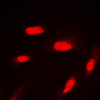 AKT1 + AKT2 + AKT3 Antibody (phospho-Ser246)