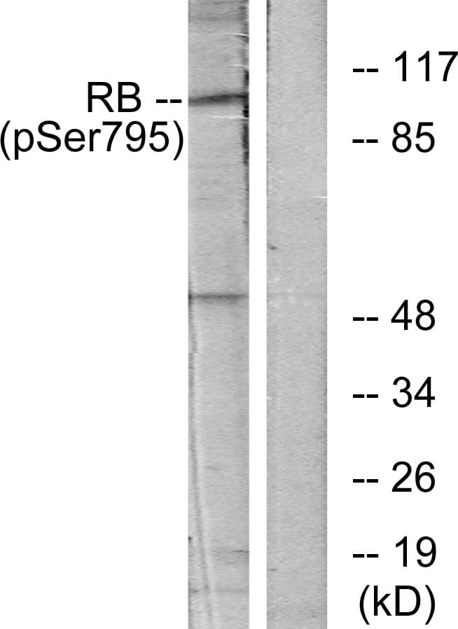 RB1 / Retinoblastoma / RB Antibody (phospho-Ser795)