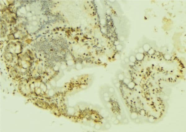 Polyclonal Rabbit anti-Human FOXM1 Antibody (IHC, WB)