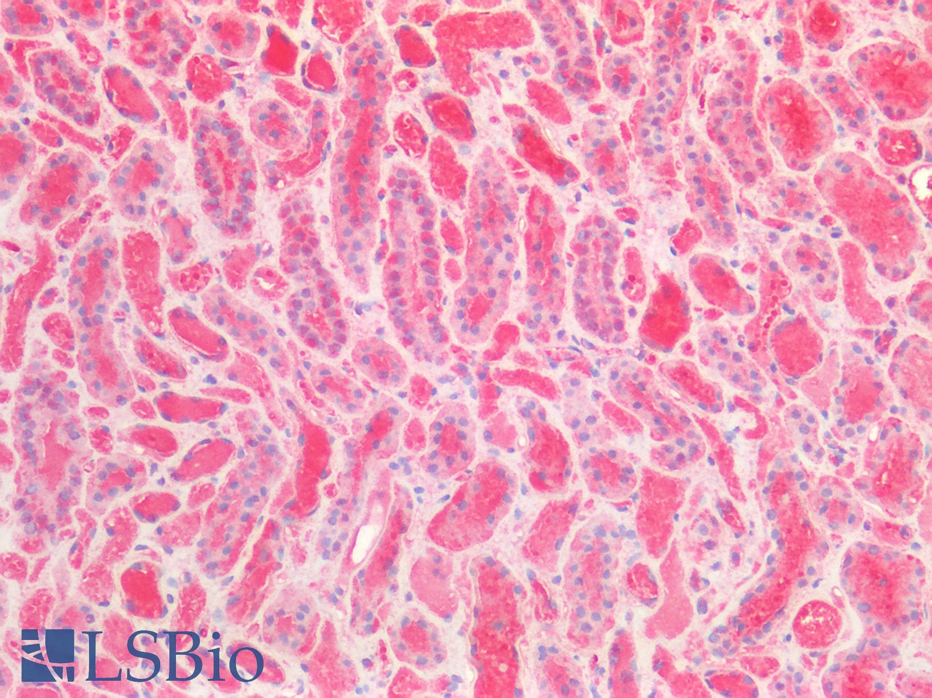 PathPlus™ ALDH1A1 / ALDH1 Antibody