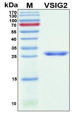 Human VSIG2 Protein (Recombinant 6His, N-terminus)