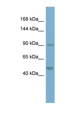 PKP2 / Plakophilin 2 Antibody (aa143-192)