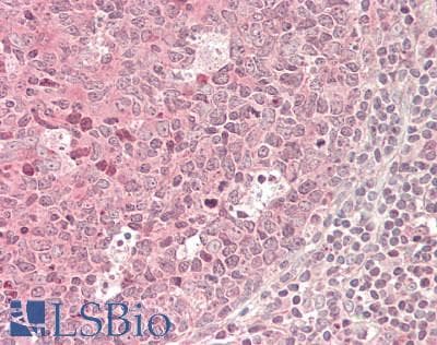 IHC-plus™ Polyclonal Rabbit anti-Human CASP3 / Caspase 3 Antibody (aa 29-175, IHC, WB)