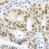 SNRPE Antibody