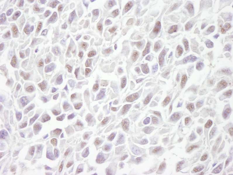 Polyclonal Rabbit anti-Human SMC3 / HCAP Antibody (aa1175-C-term, IHC)