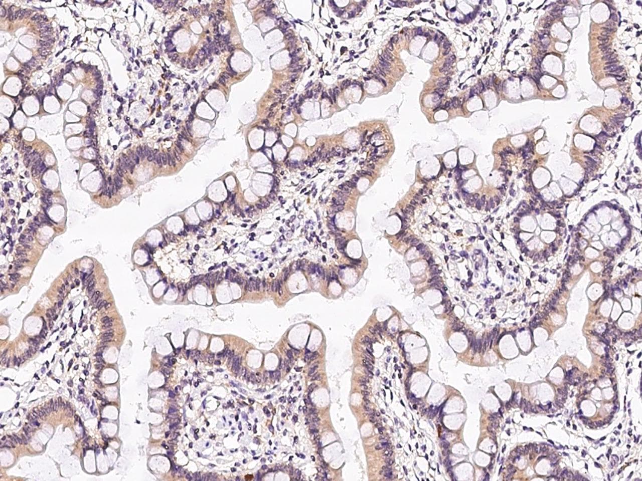 TRP32 / TXNL1 Antibody
