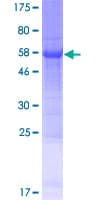Human C3orf70 Protein (Recombinant GST)
