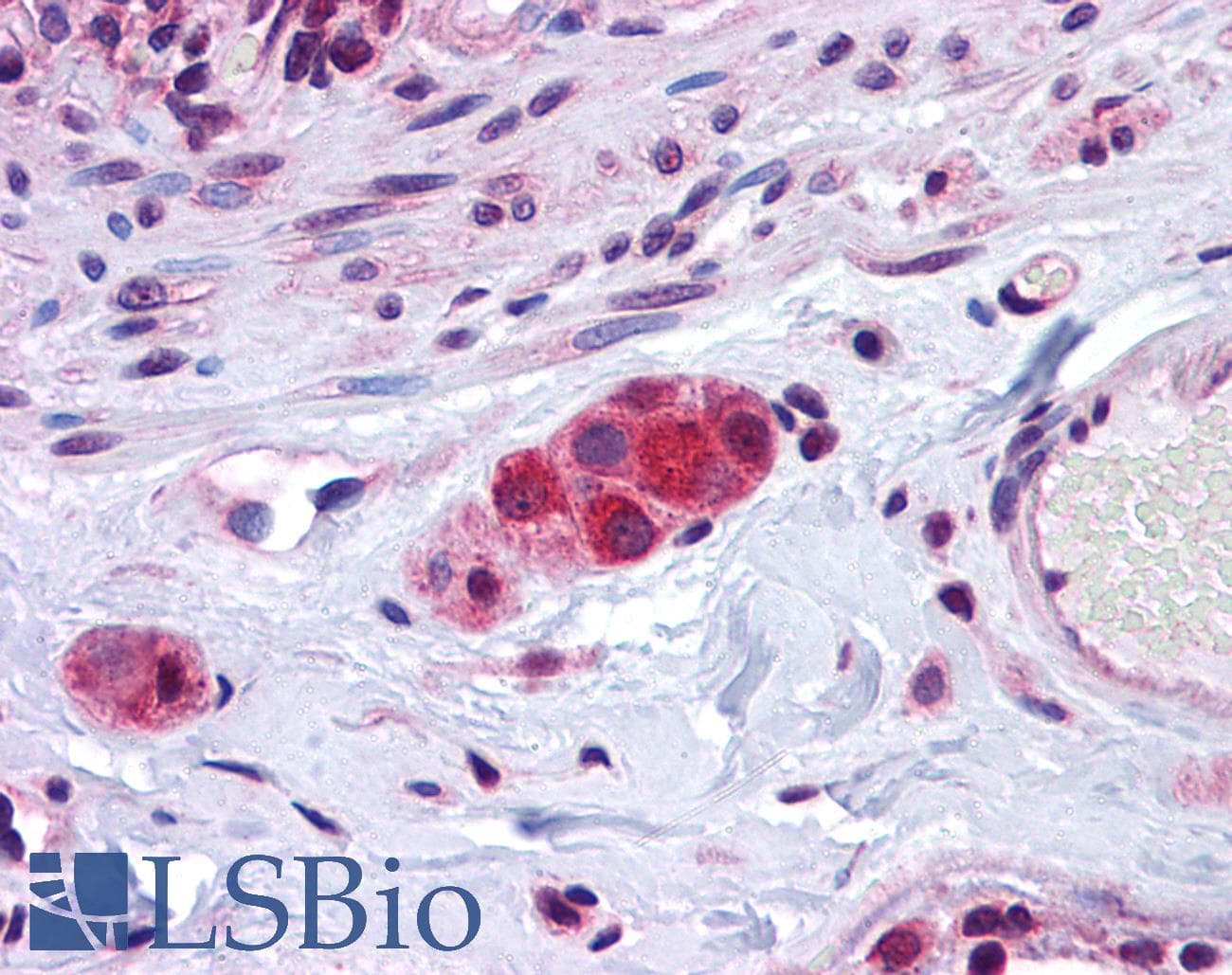 IHC-plus™ ZEB2 / SIP-1 Antibody