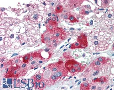 PathPlus™ CHAT Antibody (aa517-732)