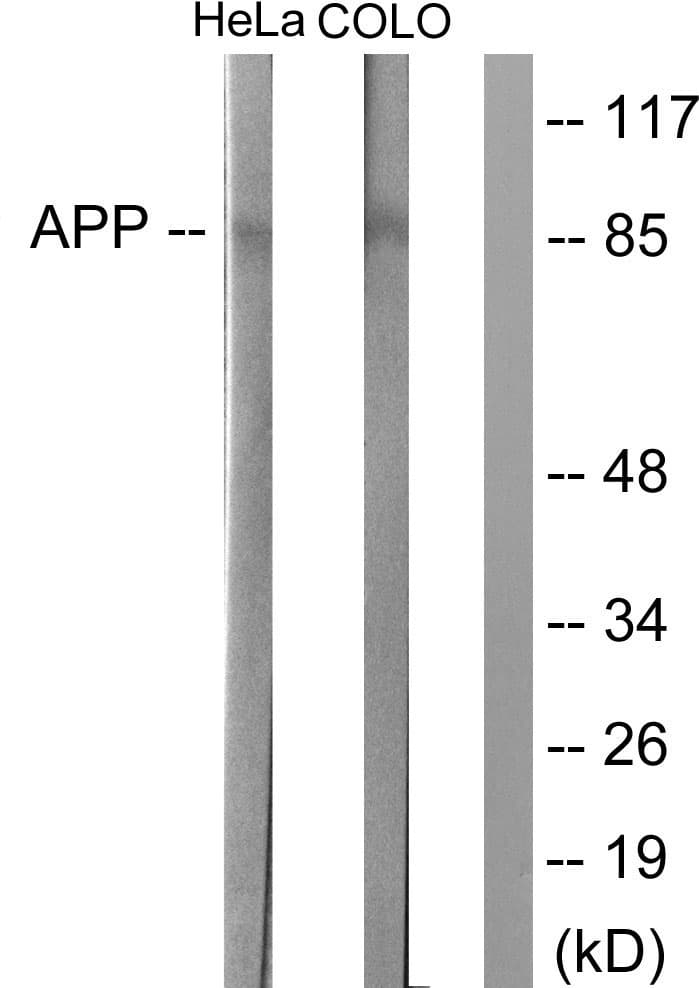 Polyclonal Rabbit anti-Human Beta Amyloid Antibody (aa711-760, IHC, IF, WB)