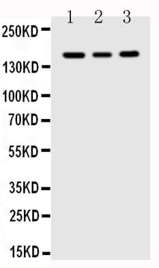FLT1 / VEGFR1 Antibody (aa1299-1317)