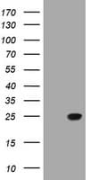 TCL / RHOJ Antibody (clone OTI5E5)