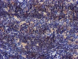 PYCRL Antibody (clone OTI3E1, Carrier-free)