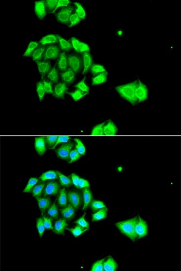 RAD51L3 / RAD51D Antibody